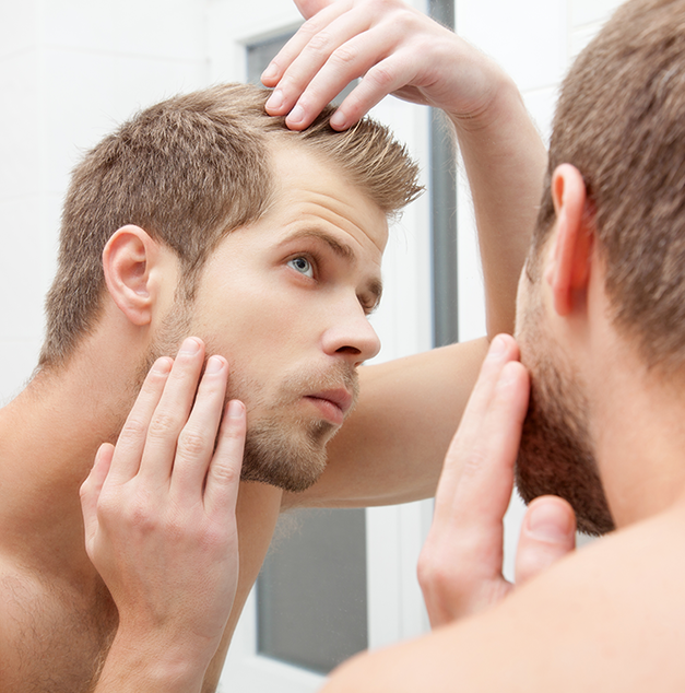 Testosterone Causes Hair Loss in FL
